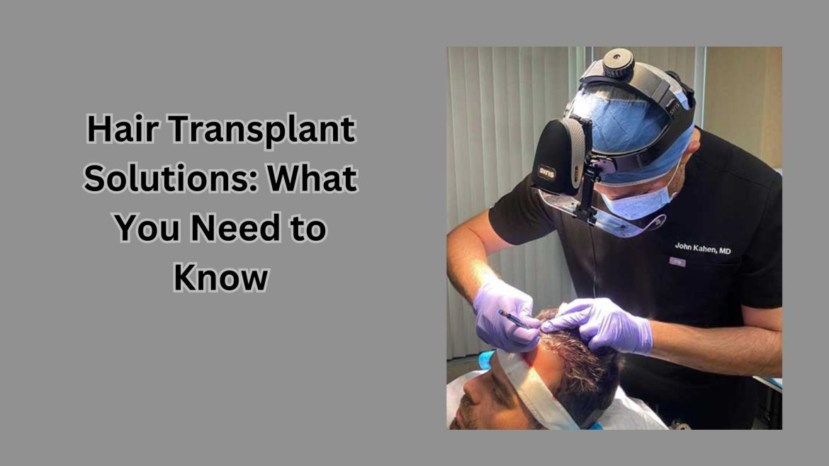 Hair Transplant Solutions: What You Need to Know