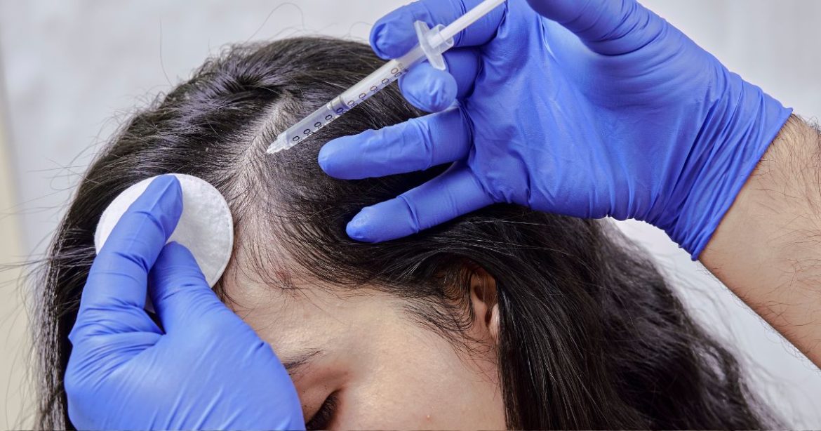 Mexico Anti-Hair Loss Treatments Market: Trends, Solutions, and Regulatory Landscape