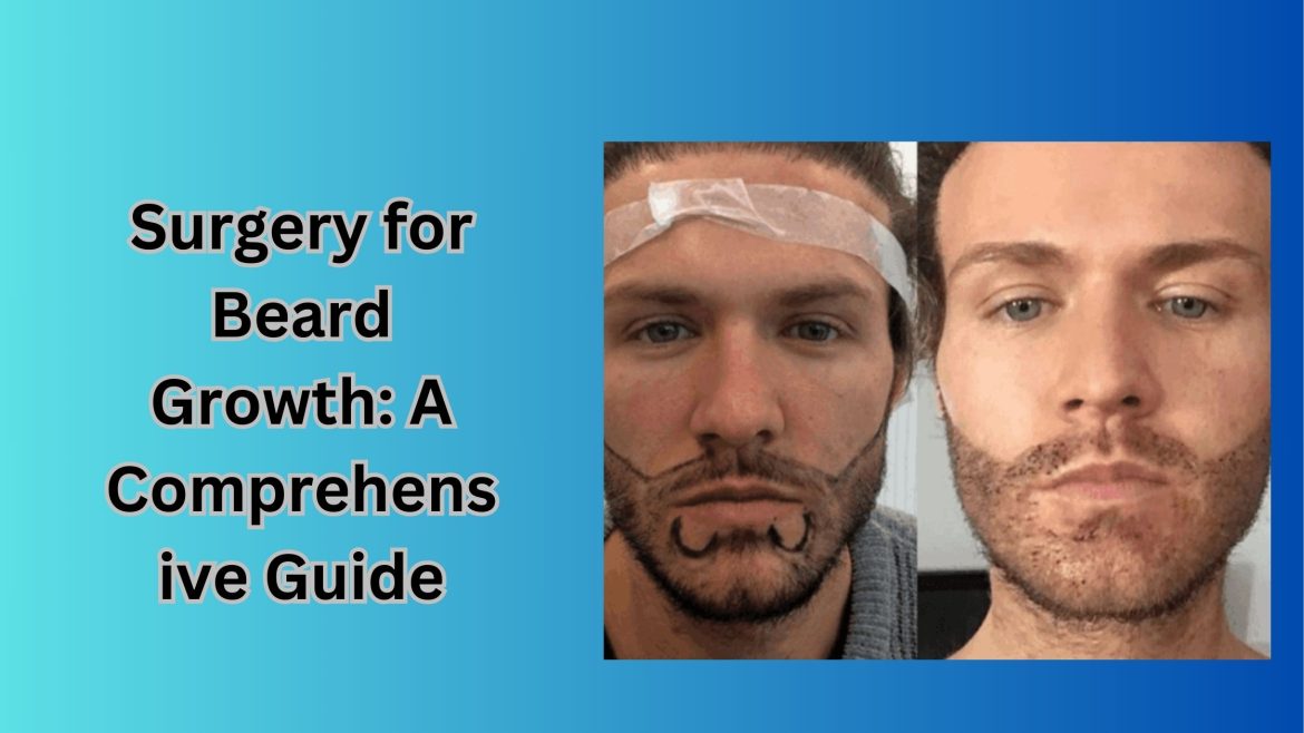 Surgery for Beard Growth: A Comprehensive Guide